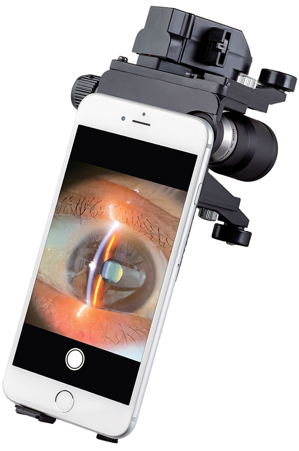 Slit Lamp Microscopes